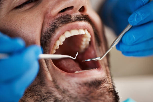 Best Emergency Dental Extractions in Old Bethpage, NY
